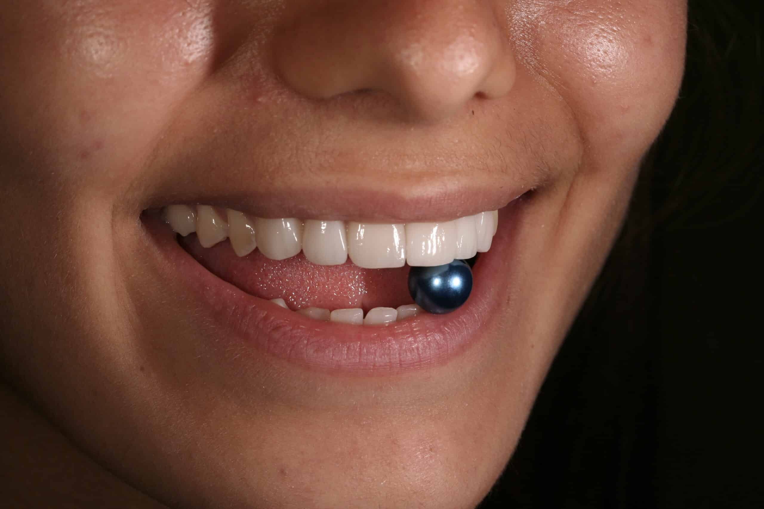 Packs Dentales - Diagonal Clinic Dental